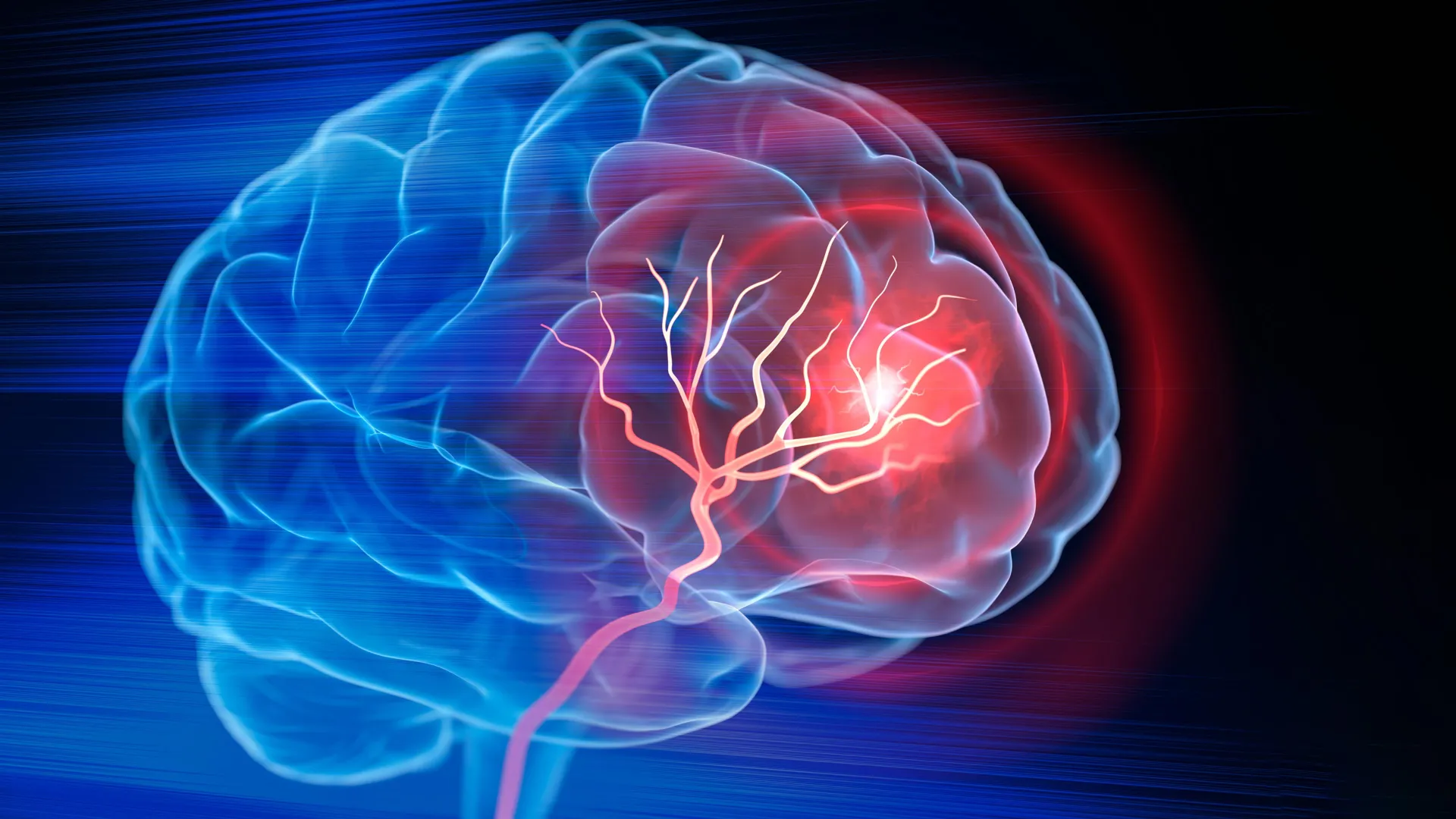 Your brain shows damage before your blood pressure even rises