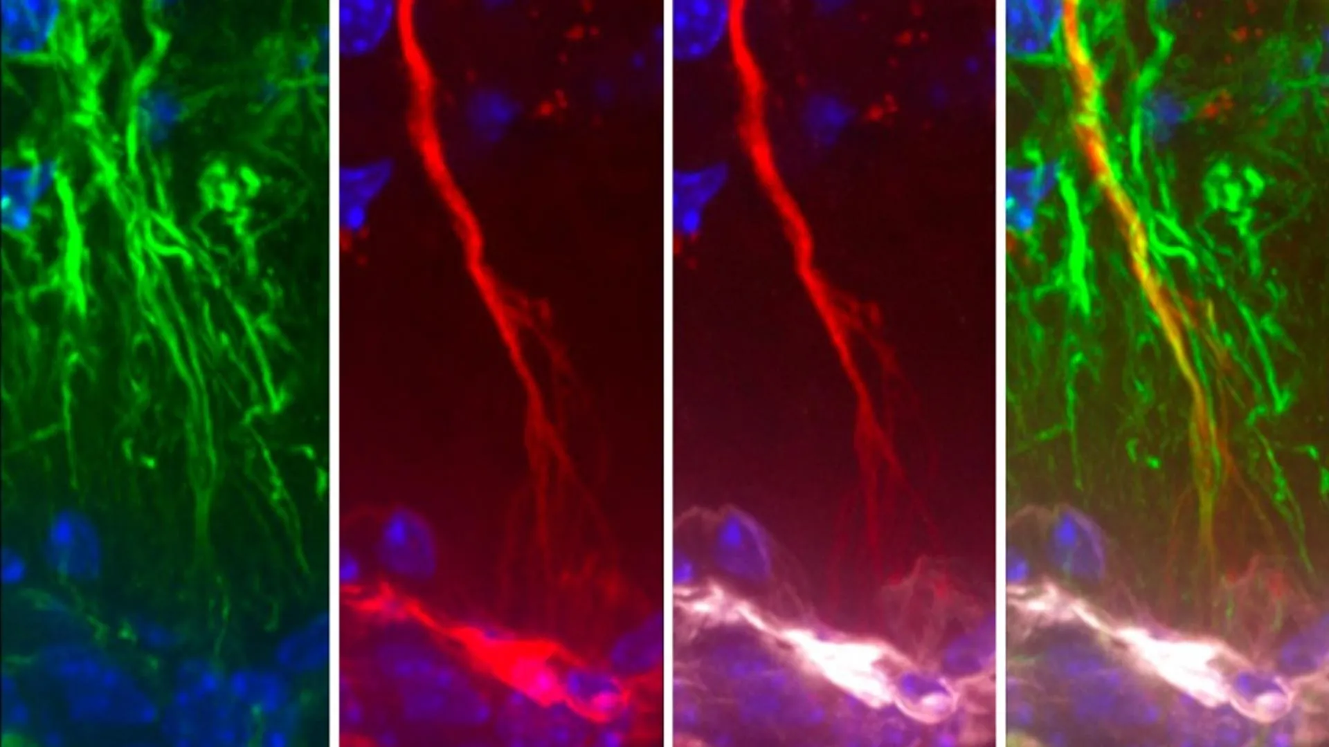 Scientists discover hidden brain cells that may stop Alzheimer’s tau buildup